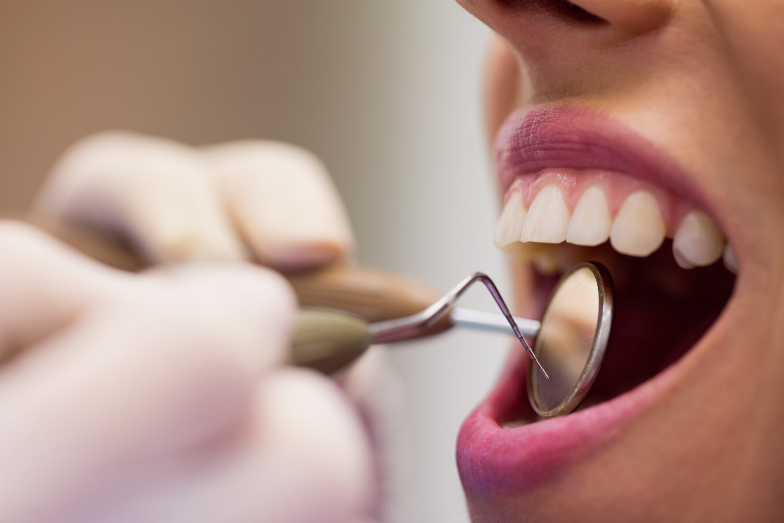 imagen de una paciente examinando por un dentista