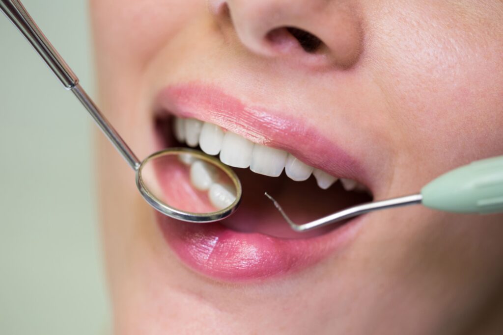 imagen de una boca siendo examinada por el dentista